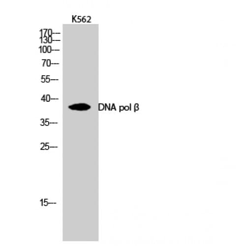 POLB / DNA Polymerase Beta Antibody (270-350 aa, C-terminal)