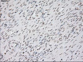 KRT8 / CK8 / Cytokeratin 8 Antibody (clone OTI1B12)
