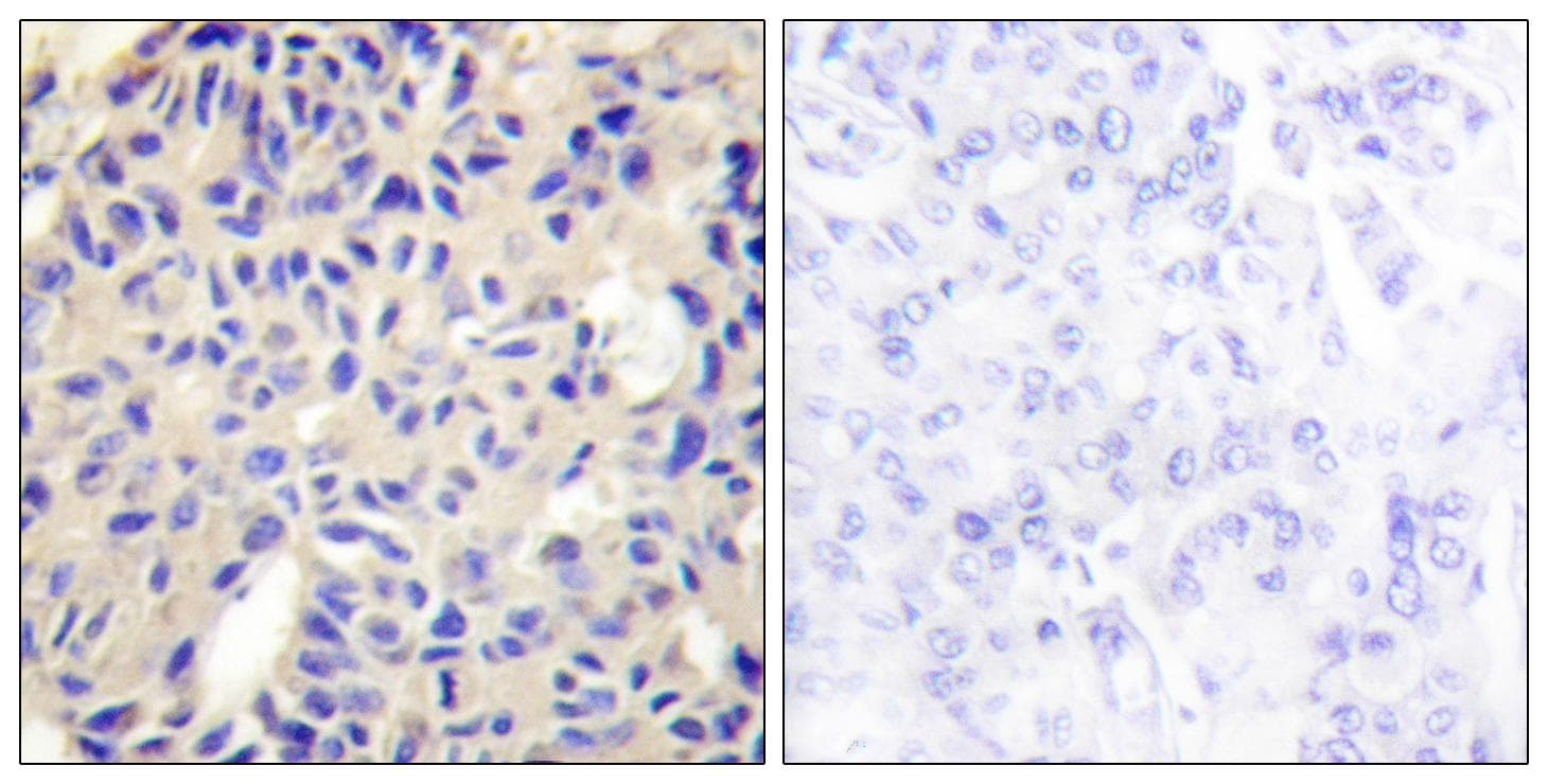 COL5A2 / Collagen V Alpha 2 Antibody