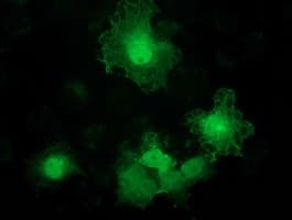 ADH2 / ADH1B Antibody (clone OTI3C12, Carrier-free)