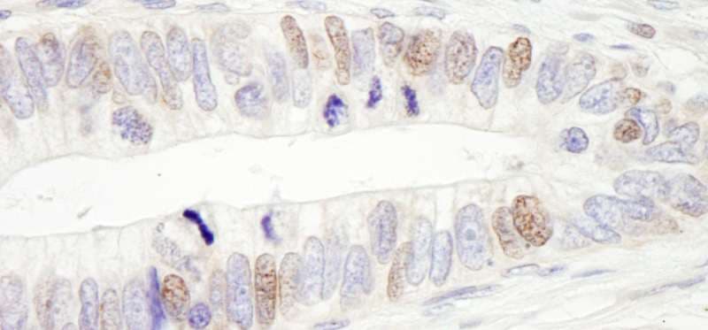 USP10 Antibody (aa300-3500)