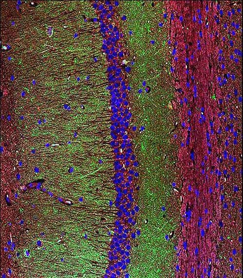 Polyclonal Rabbit anti-Human SYP / Synaptophysin Antibody (aa225-253, IHC, IF, WB)