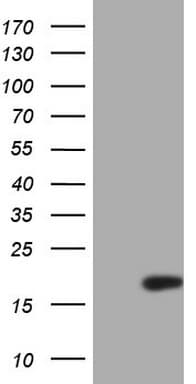 p16INK4a / CDKN2A Antibody (clone OTI9H8)