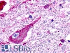 PathPlus™ Polyclonal Rabbit anti-Human GPR176 Antibody (C-Terminus, IHC)
