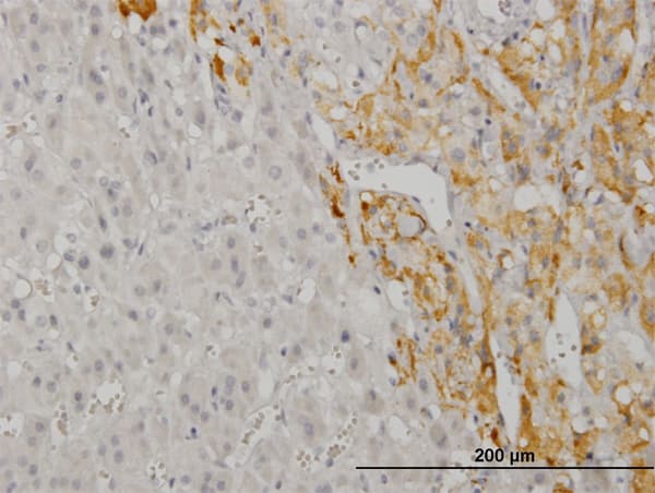 CREB5 Antibody (clone 8A5)