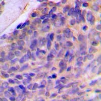 LGALS8 / Galectin 8 Antibody (Internal)