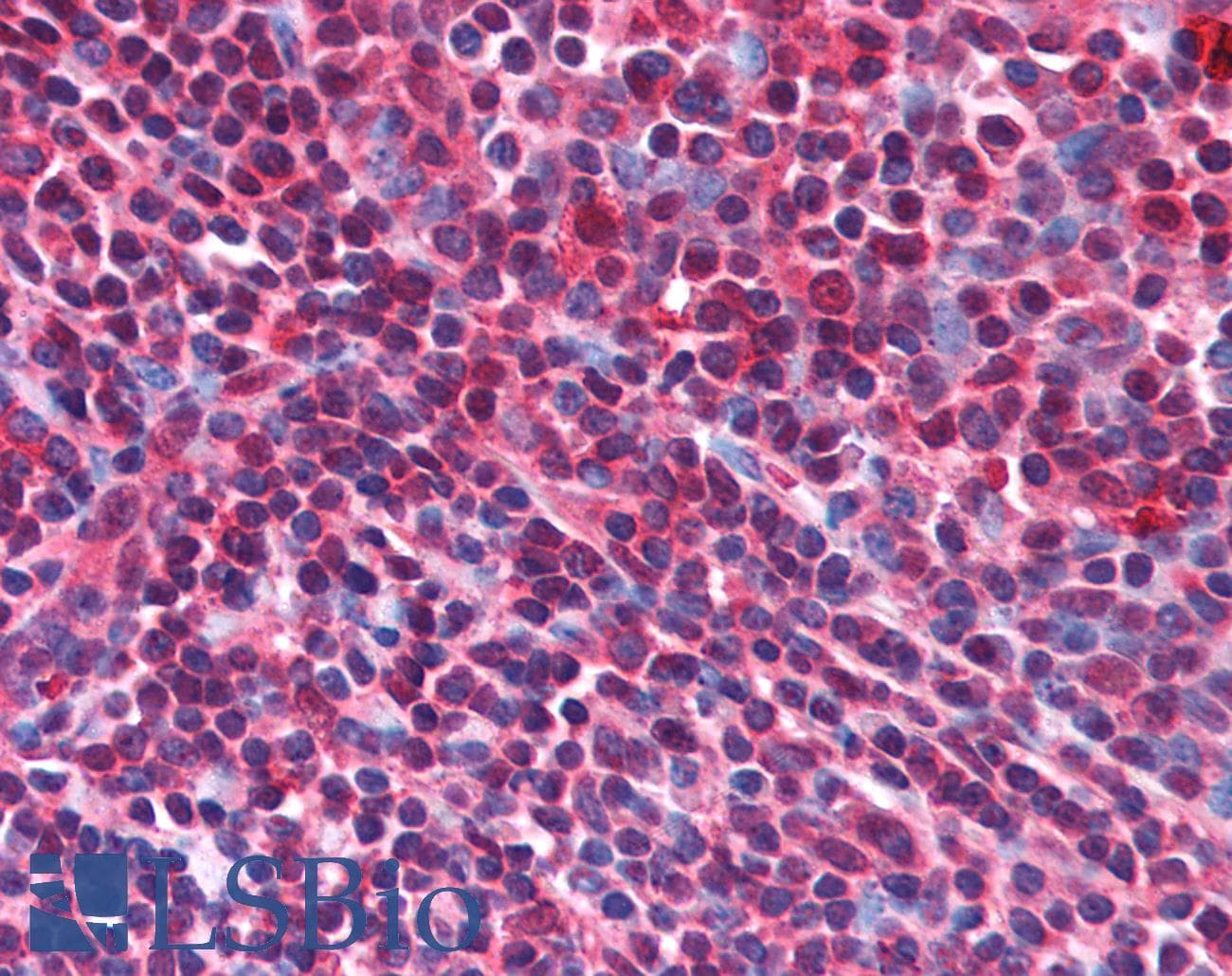 IHC-plus™ AIM / CD5L Antibody (N-Terminus)