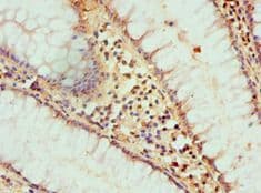 HAT1 Antibody (aa245-419)
