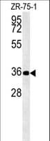 DPF3 Antibody (aa143-171)