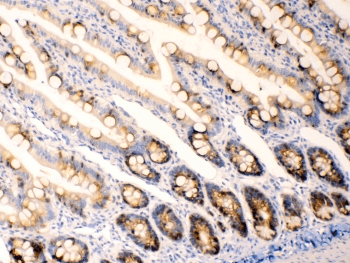Polyclonal Rabbit anti-Human AGR2 Antibody (IHC, WB)