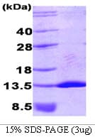 Human NEDD8 Protein (Recombinant His)