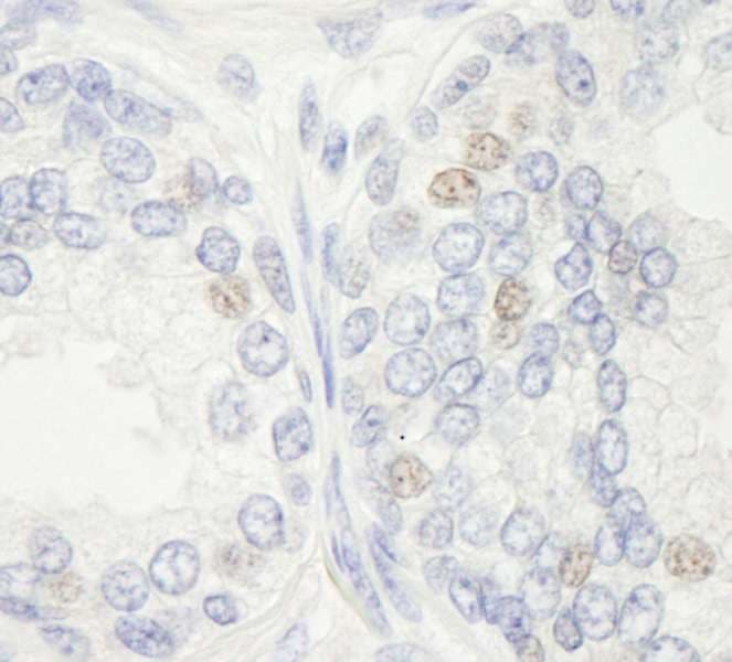 Polyclonal Rabbit anti-Human ERCC4 / XPF Antibody (aa855-905, IHC)