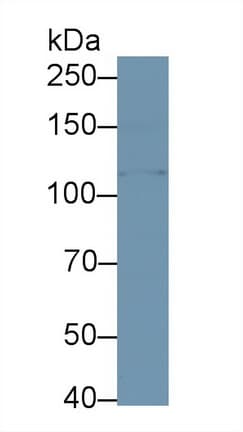 KLB / Beta Klotho Antibody (aa517-636)