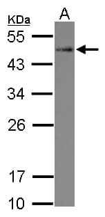 Polyclonal Rabbit anti-Human STYXL1 Antibody (IHC, WB)