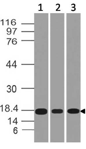 SOD1 / Cu-Zn SOD Antibody