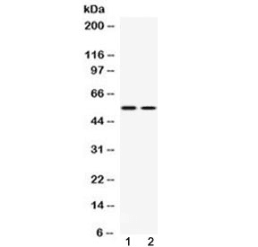 SLC18A3 / VACHT Antibody