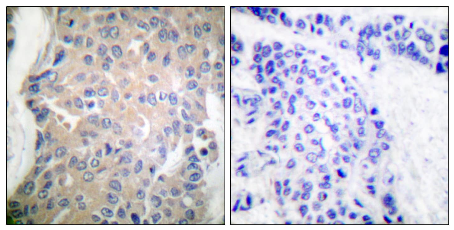 Polyclonal Rabbit anti-Human PPP1R14A / CPI-17 Antibody (aa5-54, IHC, IF, WB)