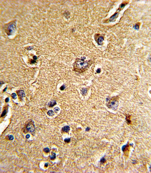 Polyclonal Rabbit anti-Human CDC23 Antibody (aa140-168, IHC, WB)