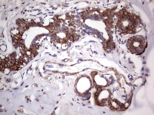 Monoclonal Mouse anti-Human TLK2 Antibody (clone OTI3F2, aa1-296, IHC, WB)