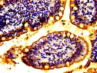 ABCC2 / MRP2 Antibody