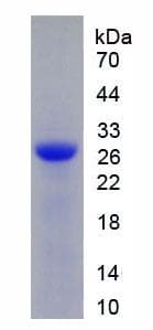Human DNASE1 / DNase I Protein (Recombinant His, N-Terminal)