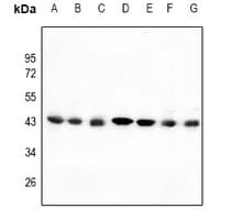 C/EBP Alpha / CEBPA Antibody