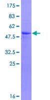 Human RCHY1 / PIRH2 Protein (Recombinant GST)
