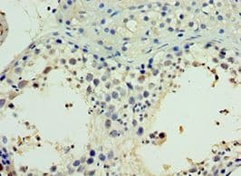 NR2C2 / TAK1 Antibody (aa240-380)