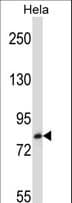 Polyclonal Rabbit anti-Human TRIM37 / TEF3 Antibody (aa936-964, WB)