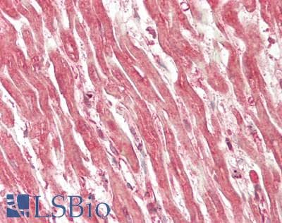 IHC-plus™ UBE2I / UBC9 Antibody