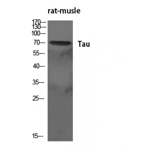 MAPT / Tau Antibody (470-550 aa)