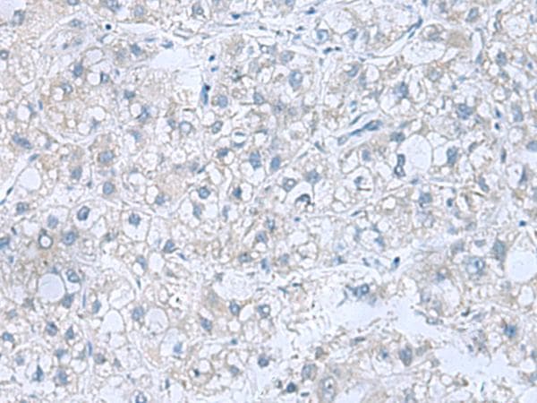 ATP6V1C1 Antibody