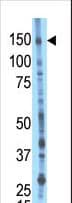 BMP2K / BIKE Antibody (aa260-291)