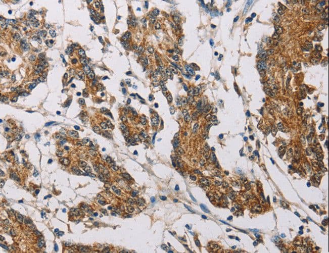 FXYD1 / Phospholemman Antibody