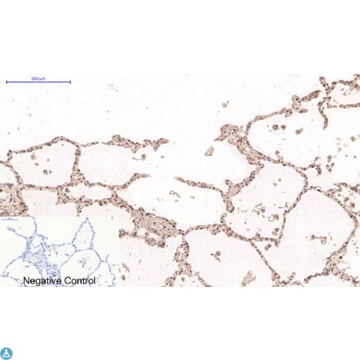 DES / Desmin Antibody
