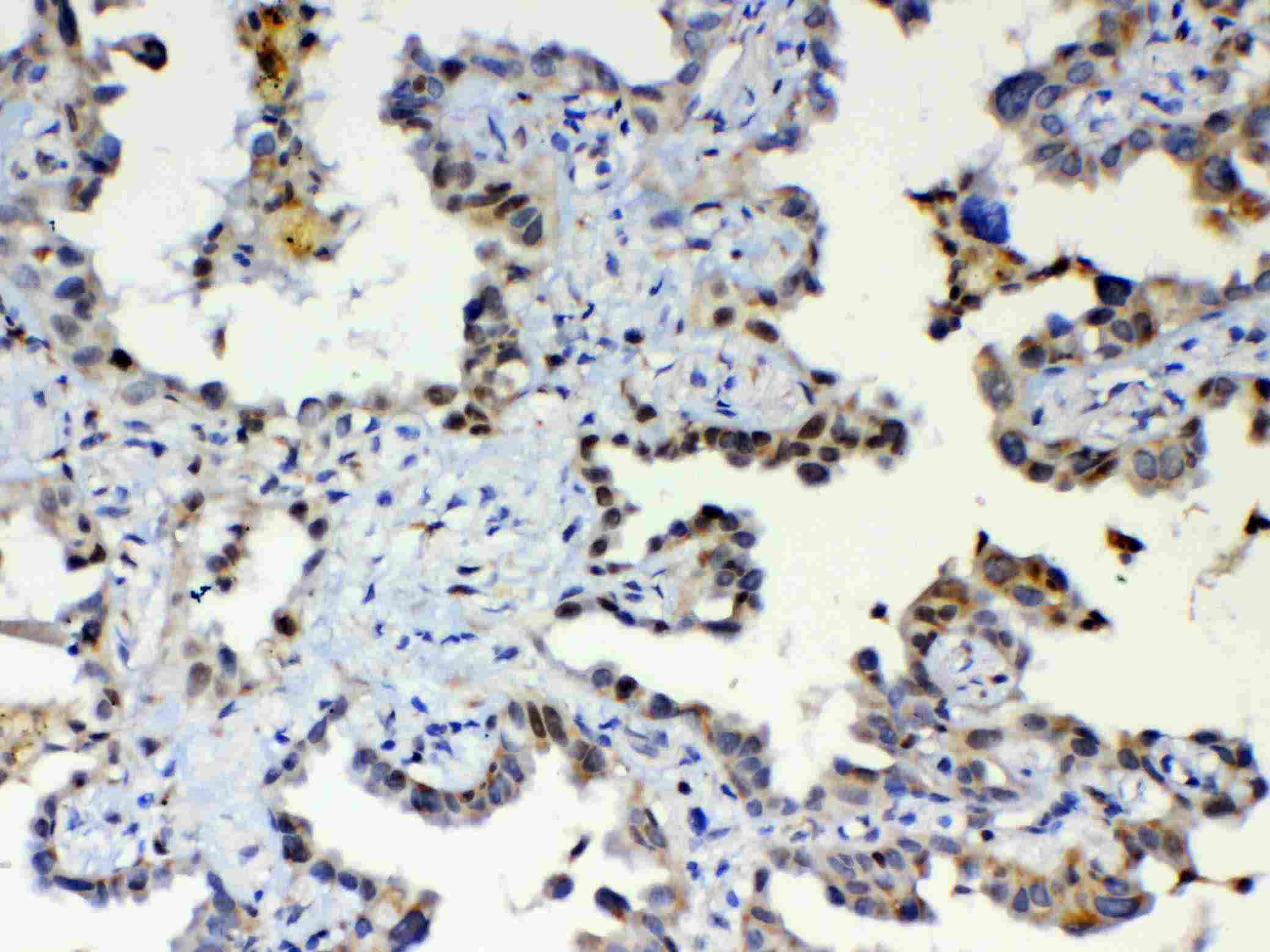 Polyclonal Rabbit anti-Human ETV6 / TEL Antibody (IHC, WB)