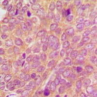 SYK Antibody (Internal)