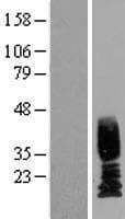 Human UPK2 / UPII / Uroplakin 2 Protein (Over-Expression Lysate Myc-DDK (Flag))