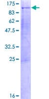 Human KIF3B Protein (Recombinant GST)