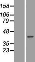 CA10 / Carbonic Andhydrase X Protein (Over-Expression Lysate Myc-DDK (Flag))