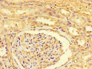 Polyclonal Rabbit anti-Human ZRSR1 Antibody (IHC)