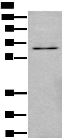 Ubiquilin 2 / UBQLN2 Antibody