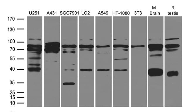 Polyclonal Rabbit anti-Human WDR48 Antibody (WB)