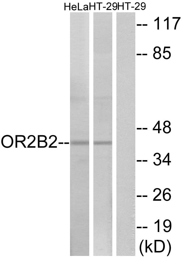 Polyclonal Rabbit anti-Human OR2B2 Antibody (aa241-290, IF, WB)