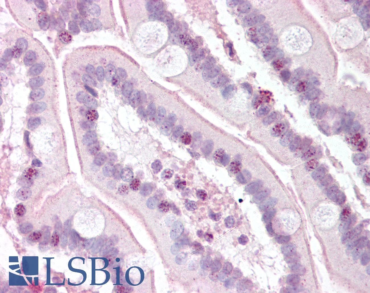 IHC-plus™ RTEL1 Antibody (N-Terminus)
