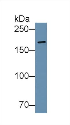 VCL / Vinculin Antibody (aa879-1064, APC)