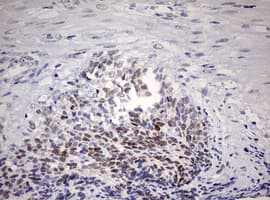 TOP2A / Topoisomerase II Alpha Antibody (aa1100-1531, clone OTI5E6, Carrier-free)