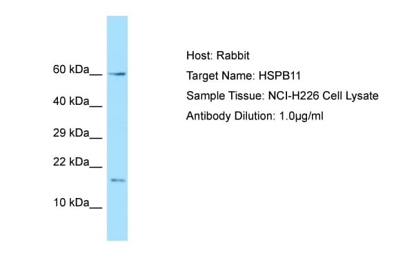 Polyclonal Rabbit anti-Human HSPB11 Antibody (aa6-55, WB)