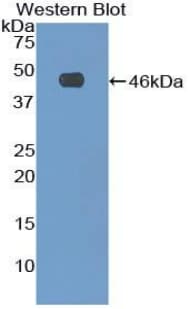 FBN1 / Fibrillin 1 Antibody (aa81-236)
