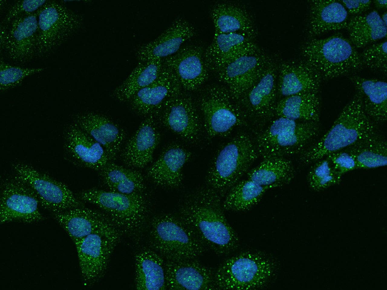 ACYP1 Antibody